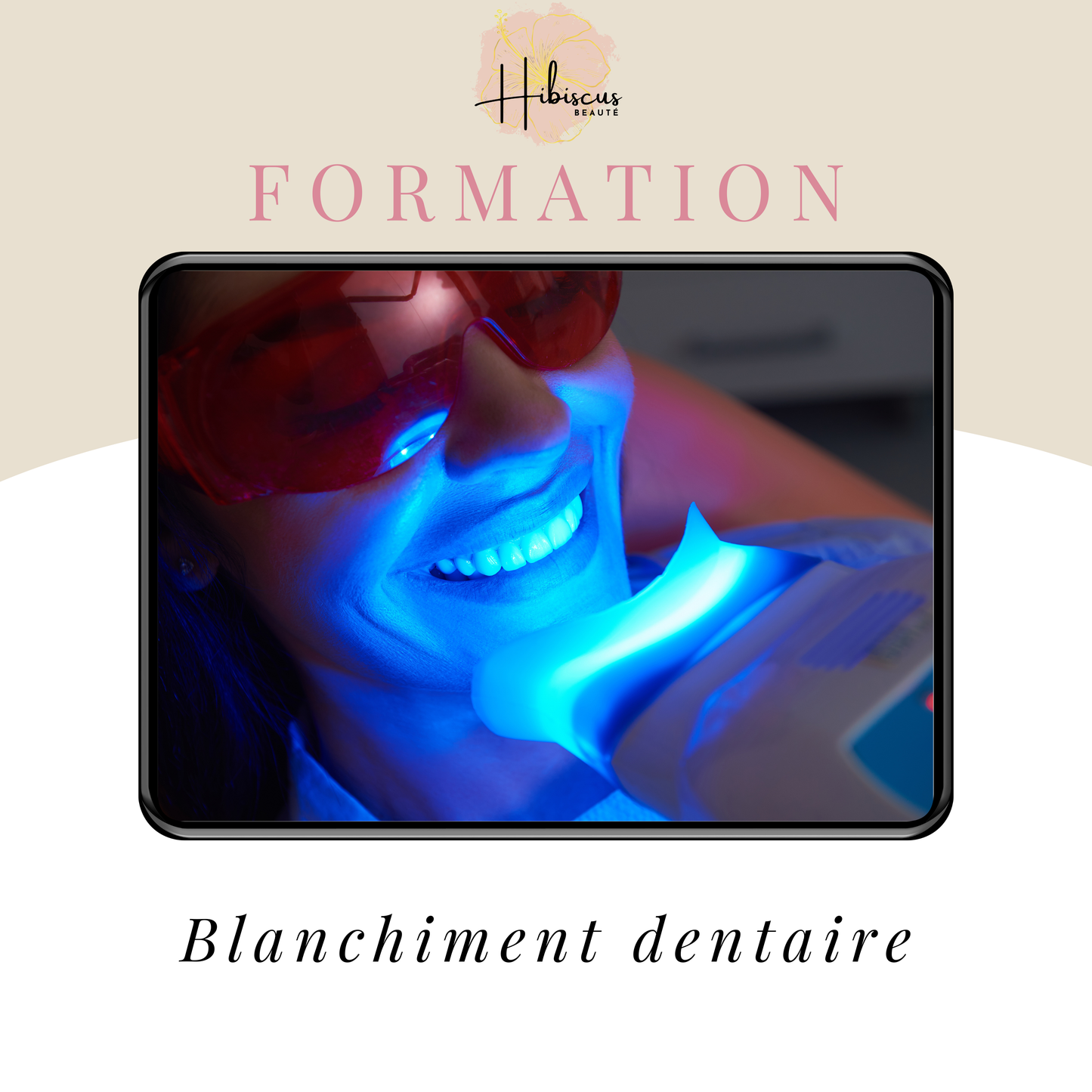 Blanchiment dentaire en ligne